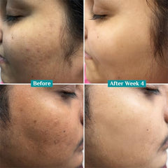 Pilgrim 10% Vitamin C Face Serum for Glowing Skin with Niacinamide - 10ml | 5% Niacinamide & Glutathione, Brightening, Fades Dark Spots & Evens, Dullness, Sensitive Skin Safe, Oil Free, All Skin Types