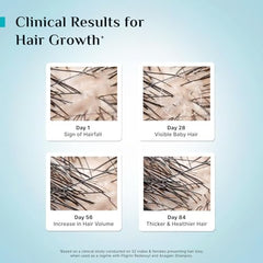 Pilgrim Advanced Hair Growth Serum with 3% Redensyl & 4% AnaGain -100ml | New Hair Growth in 28 Days, Korean Black Rice, Rosemary, Reduce Hair Fall, Hair Regrowth, Increase Hair Density, Thicker Hair