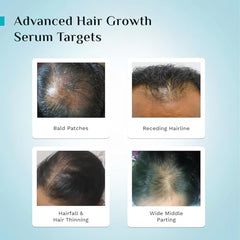 Pilgrim Advanced Hair Growth Serum with 3% Redensyl & 4% AnaGain -100ml | New Hair Growth in 28 Days, Korean Black Rice, Rosemary, Reduce Hair Fall, Hair Regrowth, Increase Hair Density, Thicker Hair