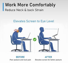 BetterBulk Adjustable Aluminum Laptop Stand for Desk with Foldable Ergonomic Design and Complimentary Mobile Stand, Compatible with MacBook, HP, Dell, Lenovo and Tablets