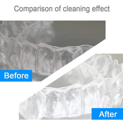 Syga Sonic Cordless Denture Cleaner Jewelry Coins Cleaning Machine (White)