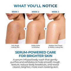 Aqueria Oil Control 3% Niacinamide French Face Serum for Oily & combination Skin with 2% BHA | Oil Free & Non Comedogenic Mattifying Anti Acne Serum | Fades Acne Marks & Reduces Dark Spots | Reduces Blackheads, Excess Oil & Bumpy Texture | Lightweight &…