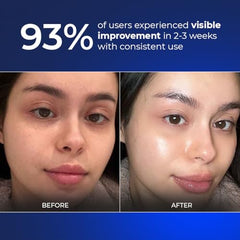 Aqueria Oil Control 3% Niacinamide French Face Serum for Oily & combination Skin with 2% BHA | Oil Free & Non Comedogenic Mattifying Anti Acne Serum | Fades Acne Marks & Reduces Dark Spots | Reduces Blackheads, Excess Oil & Bumpy Texture | Lightweight &…