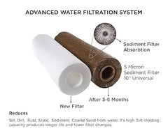 AQUA QIM Pre Filter Cartridge for Water Purifier | External Pre Cartridge Kit with Spun Filter & Accessories
