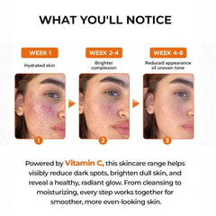 Aqueria Oil Control 3% Niacinamide French Face Serum for Oily & combination Skin with 2% BHA | Oil Free & Non Comedogenic Mattifying Anti Acne Serum | Fades Acne Marks & Reduces Dark Spots | Reduces Blackheads, Excess Oil & Bumpy Texture | Lightweight &…