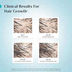 Pilgrim Advanced Hair Growth Serum with 3% Redensyl & 4% AnaGain -100ml | New Hair Growth in 28 Days, Korean Black Rice, Rosemary, Reduce Hair Fall, Hair Regrowth, Increase Hair Density, Thicker Hair