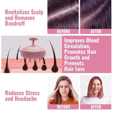 MOMISY Scalp Massager Shampoo Brush, Eco-Friendly Wheat Straw Body With Soft Silicon Bristles, Hair Scalp Scrubber, Scalp Exfoliator | Dandruff Removal, Prevents Hair Loss For Men, Women (Pink)